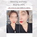 중산6길R | 전주 리프팅 전문샵에서 윤곽 라인 제대로 효과 보기