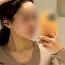 일산피부과 온다리프팅 후기 및 가격 온다리프팅잘하는 곳