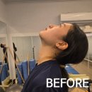 강남정성약국 | 강남역 필라테스 클래스바디, 너무 좋아서 통증관리하러 또 다녀온 후기