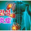 우리 몸의 염증(炎症)에 관하여..... 이미지