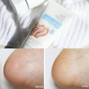 에네스스킨