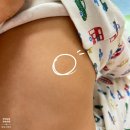 유스티나 | 아기피부 오돌토돌 동전습진 라라메드 베이비로션 추천
