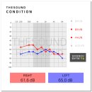 세기보청기 이미지