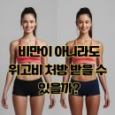 뉴욕온누리약국 | 고도 비만 아니라도 위고비 처방 받을 수 있나? 부작용은?