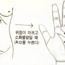 수지침 이미지