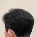 마이트로포 이미지