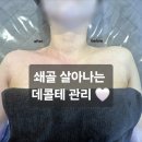 아름다움 | 주안 아름다움에스테틱 웨딩관리 🤍 데콜테 관리 후기 (라운드숄더·쇄골라인 변화)