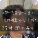필이비인후과의원 | 비염 미용코 수술 2주차 회복기 | 실밥 제거 &amp; 첫 붕대 해제 후기 - 세번째이야기)