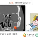 배이비인후과 이미지