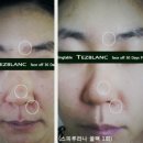 하이리빙 프로슈머 | 피부, 촉촉한 피부 만들기~엔트리 스피루리나 꿀팩 후기~[힐링테이블 건강관리사 자격증/아토피상담사...