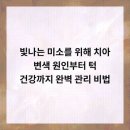 범석영치과의원 네이버블로그