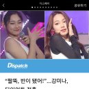 “팔뚝, 반이 됐어!”…강미나, 다이어트 전후 이미지