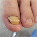 레푸스연산