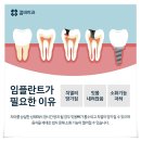 65세이상임플란트 부모님치아로 적합해요 이미지