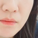 고주파 이미지