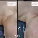정;뷰티스킨앤바디
