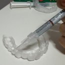 홈 | 치과 처방 셀프치아미백 부작용 없는 뷰티스 홈 후기 | 오스템 뷰티스 홈 15%