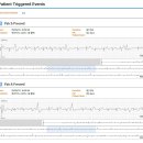 마곡스카이내과의원 | [마곡스카이내과의원] 두근거림 증상이 있을 때 검사 및 치료