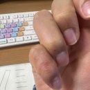 윤제한의원 | 지연성 알러지 검사 후기