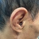 필립스보청기대전센터 | 대전보청기 오티콘보청기 대전서구센터에서 만족스러운 보청기 맞춤 후기