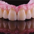 광테크치과기공소 이미지