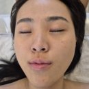스파보레스킨앤바디 | 대구웨딩관리 대봉동윤곽관리 대구웨딩바디관리 잘하는 "라숲 스킨앤바디스파" 에서 산소필 받고온 후기:)