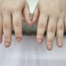 시흥네일 맞춤케어 잘 하는 홍시언니네