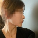 내 코를 찾아주세요 | 코필러가격 부담 없던 코필러잘하는곳 추천! 내돈내산 리얼후기