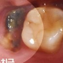 뿌리심는치과의원 이미지