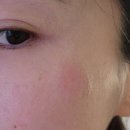 페이스필터의원 이미지