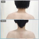 태성빌딩 | 서현피부관리 :) 에스테리나 분당 서현점, 동안 얼굴 윤곽·리프팅·물광 피부 케어 솔직후기