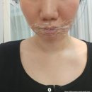 릴리뷰티 | 동탄 눈썹 맛집 릴리뷰티샵에서 입술 관리 받고 안색 살아난 추천후기!