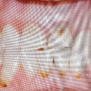 예스부부치과의원 티스토리