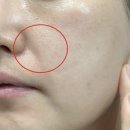 라라 | 라라필 후기 효과, 부작용 총정리(30대 필독)