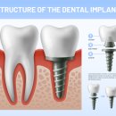 탑치과기공소 | 서초 임플란트 치과 후기 좋은 곳 TOP3