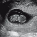 이즈맘산부인과의원 이미지