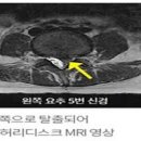 허벅지 근육 통증 원인은? 이미지