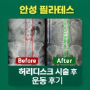 문터1길 | 안성 필라테스 허리디스크 시술 후 운동 후기｜공도필라테스 실제 변화 사례