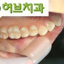 구리허브치과 네이버블로그