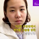 비씨아이성형외과의원 이미지