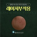프락셀부작용 붉은기 홍조 언제까지 갈까? 올바른 치료 가이드