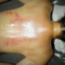 213 | 호평동피부관리 다정뷰티살롱 등관리 받은 후기