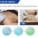 알라딘필링 이미지