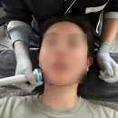 남양 피부관리는 필라에틱, 화성 피부관리, 플라즈마 시술 후기