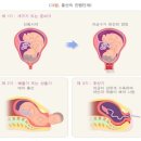 마왕손만두 | [임신 일기] 24화 : 마지막 정기 검진 & 이슬 목격! (38주차)