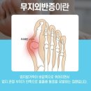 우무지 이미지
