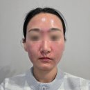 궁금한 키, 궁금한 사춘기 | 울트라클리어 가격 &amp; 효과 / 울트라클리어 모공 후기!