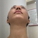 베스트한의원 | 안면비대칭한의원 교정 가격 추나 치료 솔직 후기