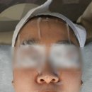 동안라인스킨케어 | 동탄 피부관리 가격 대비 만족도 최고 루체 스킨케어에서 턱라인 살아난 후기