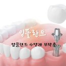 심플인플란트치과의원 이미지